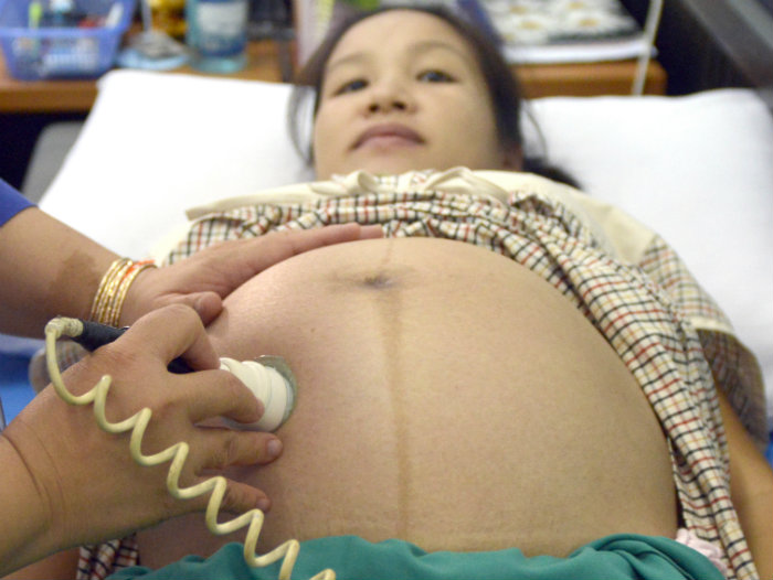 Laos Pregnant Mother